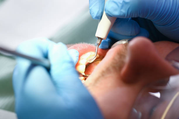 Best Emergency Treatment for Jaw Pain or Injury in Huber Heights, OH